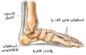 التهاب فاشیا پلنتار و درد کف پا